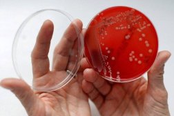 ارتفاع الحرارة يعزّز قدرة البكتيريا على البقاء حيّة (رويترز)