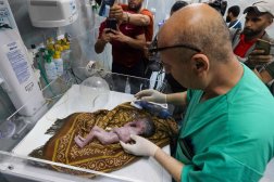 طبيب فلسطيني يستخرج جنيناً من رحم أمه التي نقلت إلى المستشفى الكويتي برفح بعد إصابتها في قصف إسرائيلي 20 أبريل (نيسان) 2024 (أ.ف.ب)